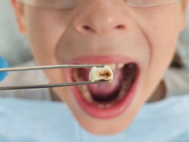 Best Emergency Gum Treatment in Kingsville, TX
